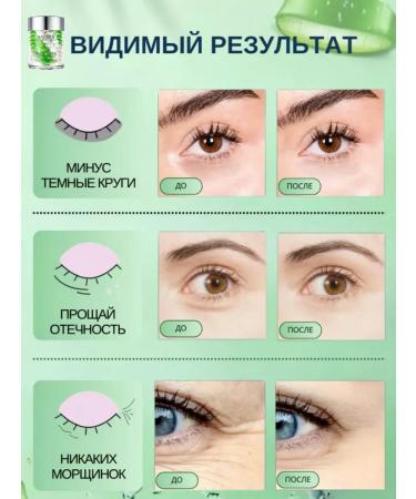 sadoer Moisturizer for eyelids and skin around the eyes from edema - Buy Online on GoSupps.com