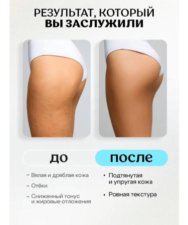 Miss Organic Anti-cellulite set for weight loss thermo-gel+cryo-cream - Buy Online on GoSupps.com