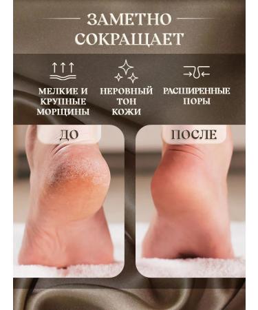 new dawn Leg cream restoring special care 150ml - Buy Online on GoSupps.com