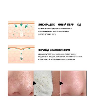 Eelhoe nasal mask for removing acne - Buy Online on GoSupps.com