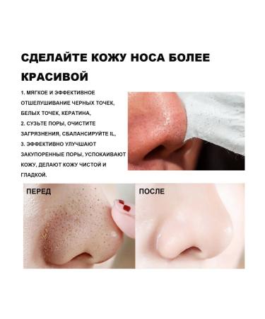 Eelhoe nasal mask for removing acne - Buy Online on GoSupps.com