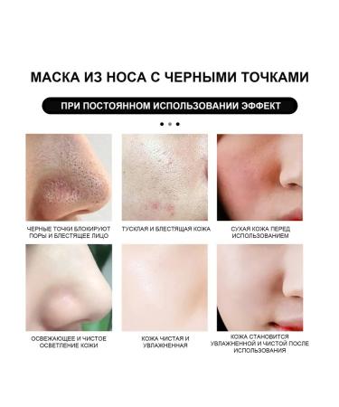 Eelhoe nasal mask for removing acne - Buy Online on GoSupps.com