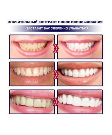 Eelhoe dazzling white dental veneers - Buy Online on GoSupps.com