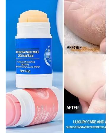 LadysPretty Cream for legs hands from cracks moisturizing dryness 2pcs - Buy Online on GoSupps.com