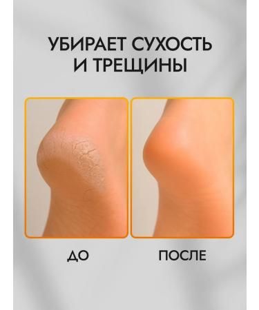 OnlyChiksa Cream wax from cracks for dry skin - Buy Online on GoSupps.com