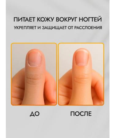 OnlyChiksa Cream wax from cracks for dry skin - Buy Online on GoSupps.com