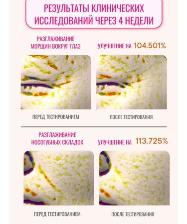 Tony Moly Cream with peptides for face anti -aging - Buy Online on GoSupps.com