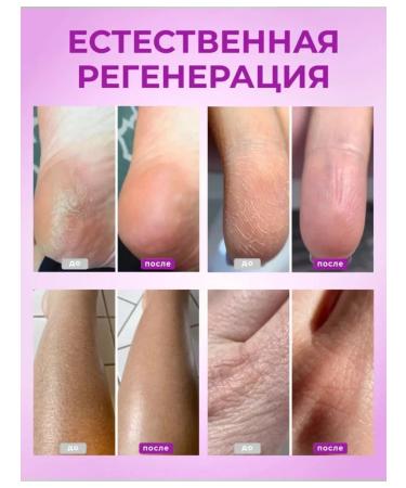 AYA Cream wax from cracks 6 pcs - Buy Online on GoSupps.com