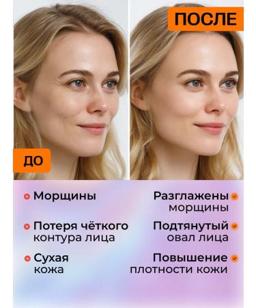 YASOMA Moisturizing serum for the face with hyaluronic acid - Buy Online on GoSupps.com