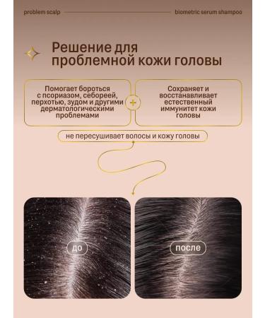 Rada Russkikh Women's hair shampoo 300 ml - Buy Online on GoSupps.com