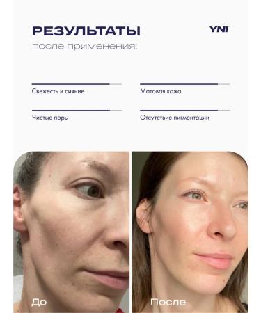 You Need It Moisturizing face with vitamin C niacinamide 1% - Buy Online on GoSupps.com