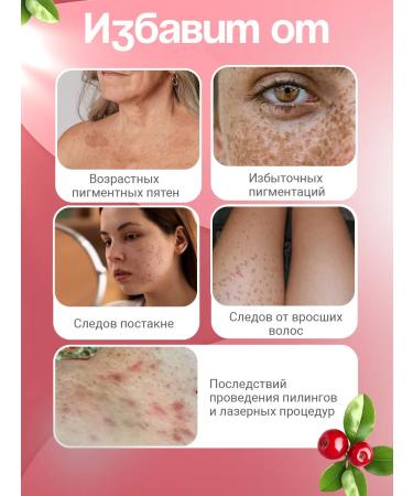 SERENA Whitening cream for the face body and intimate zone 100ml - Buy Online on GoSupps.com