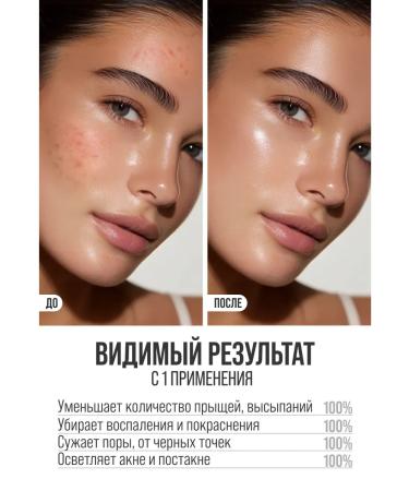 7DAYS Facial serum from acne with niacinamide 60ml - Buy Online on GoSupps.com