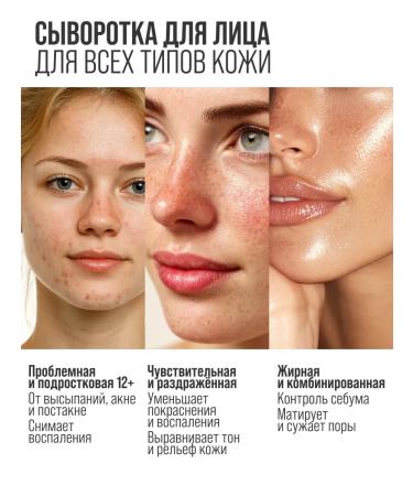 7DAYS Facial serum from acne with niacinamide 60ml - Buy Online on GoSupps.com