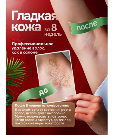 LimbaBelle Class removal photoepator - Buy Online on GoSupps.com