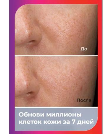 AVON ANEW updating face cream "Energy of opponol" 50 ml - Buy Online on GoSupps.com