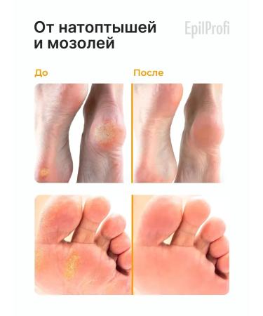 EpilProfi Cream wax from cracks for dry skin - Buy Online on GoSupps.com