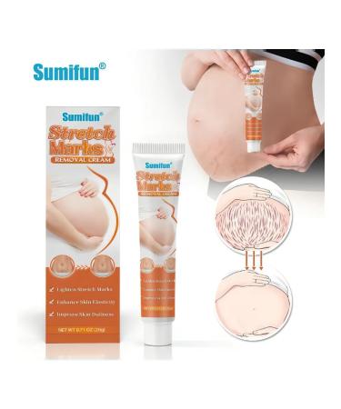 Cosmetics Moisturizing body from stretch marks and scars - Buy Online on GoSupps.com