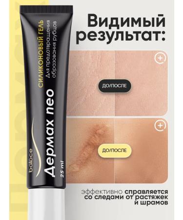 balace Dermax Neo Cream from scars and scars from stretch marks - Buy Online on GoSupps.com