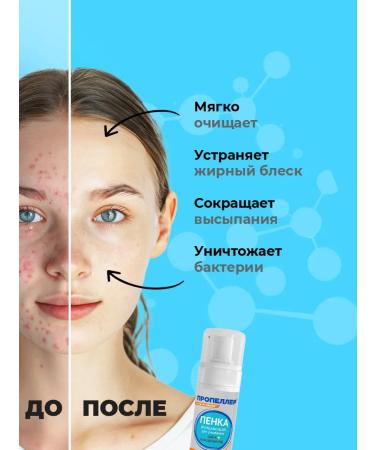 PROPELLER Foam for washing the face from acne cleansing 160ml - Buy Online on GoSupps.com
