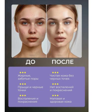 Bronze Girl Enzymal powder for the face and body with vitamin C - Buy Online on GoSupps.com