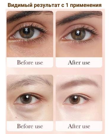 sadoer Eye -rink cream with retinol 2 pcs - Buy Online on GoSupps.com