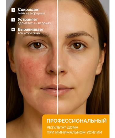 VISELLE Azelain peeling with DMAI Azelaic DMAE DETOX PEEL - Buy Online on GoSupps.com