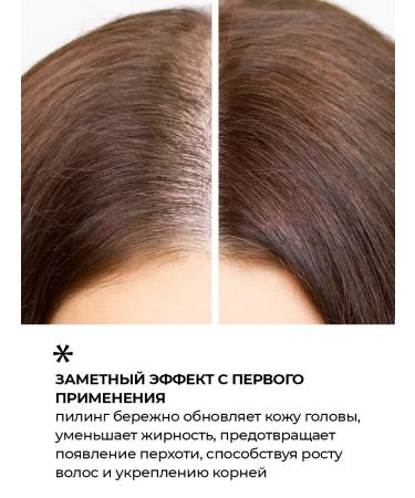 Seauty Hair and scalp peel against dandruff x2 - Buy Online on GoSupps.com