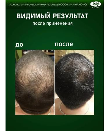 Lisap Anti-hair loss lotion - Buy Online on GoSupps.com