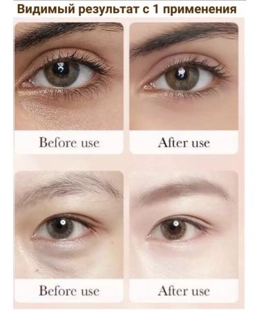 Niyara Cream around the eyes and face - Buy Online on GoSupps.com