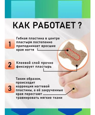 GOLDEN HOUSE Patch for ingrown nails nail plate sticker - Buy Online on GoSupps.com