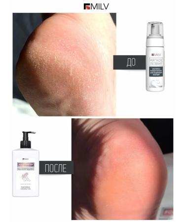 MILV Pedicure with urea - Buy Online on GoSupps.com