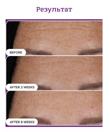 Paula's Choice Therapeutic serum with retinaldegido 30 ml - Buy Online on GoSupps.com