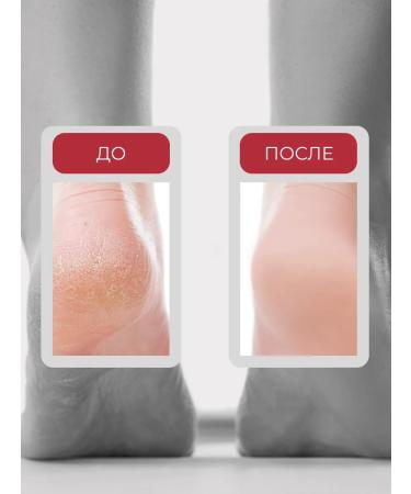 BEAUTIFIC Cream-Vosk from cracks Slovodna 100 ml - Buy Online on GoSupps.com