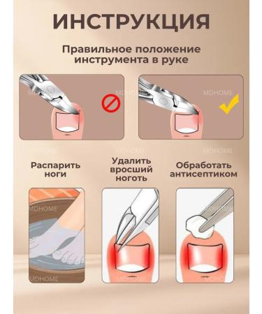 MDHOME Nitty nippers pedicure forceps - Buy Online on GoSupps.com