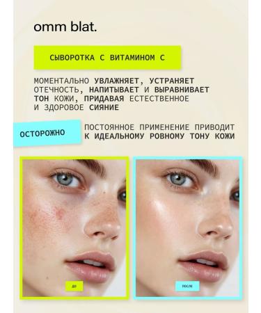 omm blat Facial serum with vitamin C niacinamide - Buy Online on GoSupps.com
