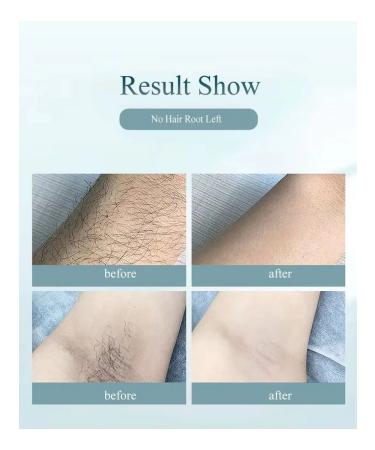 IPL Photoepilator - Buy Online on GoSupps.com