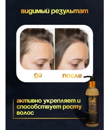MSofi Shampoo strengthening from hair loss - Buy Online on GoSupps.com