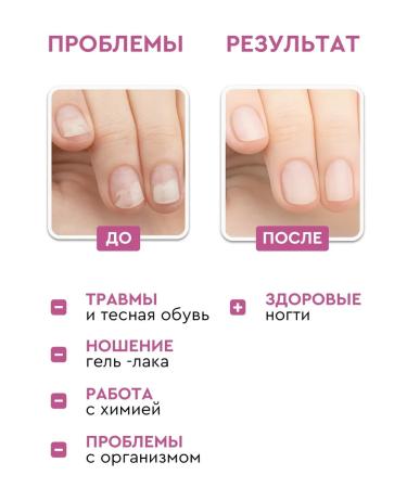INKI A set of serums for treatment for onycholysis and nail fungus - Buy Online on GoSupps.com