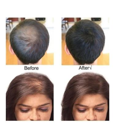 FICHER STAR Hair camouflage powder lumpy brown - Buy Online on GoSupps.com