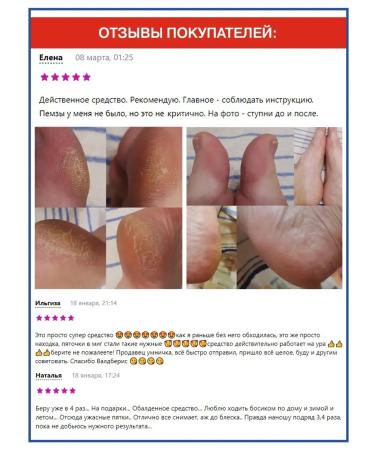 NANO-HEELS A product for the heels - Buy Online on GoSupps.com