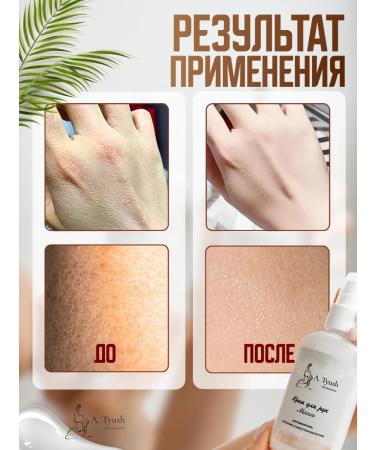 A Tyush Hand cream moisturizing nutritional - Buy Online on GoSupps.com