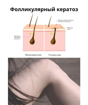 GALASOMA Salt scrub for body anti -cellulite 400 g - Buy Online on GoSupps.com