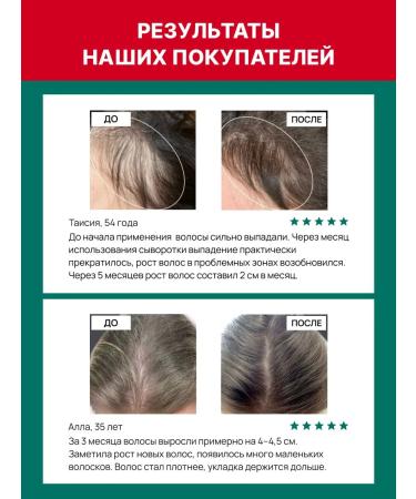 Laona Hair serum from falling out and growth - Buy Online on GoSupps.com