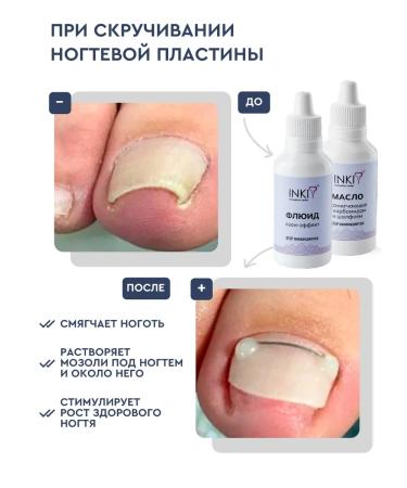 INKI Remedy for ingrown nails on the legs and hands of balm and fluid - Buy Online on GoSupps.com