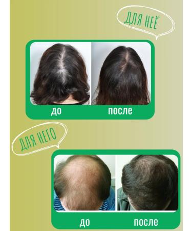 Dr Medical Oil for growth and against hair loss - Buy Online on GoSupps.com