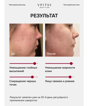 VPITAY Serum with retinol - Buy Online on GoSupps.com