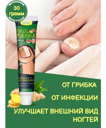 100% Original Nail fungus agent 30 g