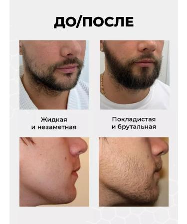 Folixidil Lotion 15% for hair growth and beard - Buy Online on GoSupps.com