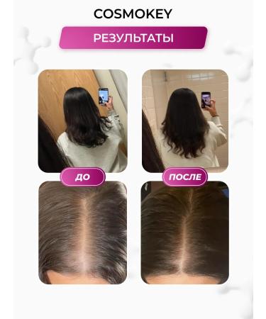 Cosmokey Soft tricapil lotion for women a set of 6 pcs - Buy Online on GoSupps.com